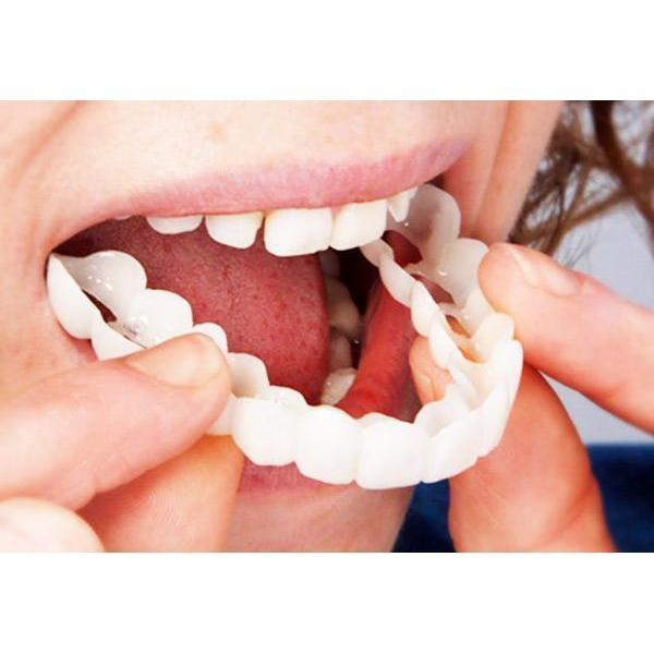 Simulation Whitening Lower Row Braces Teeth Whitening Kit Upper Row Dentures Braces Angelwarriorfitness.com